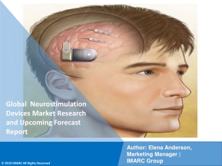 PDF- Neurostimulation Devices Market: Research Report, Share, Size, Trends and Forecast by 2021-2026