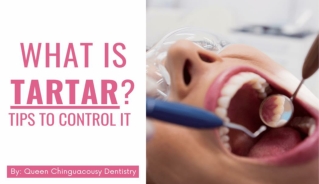 What is Tartar & Tips to Control It? By QC Dentistry Brampton