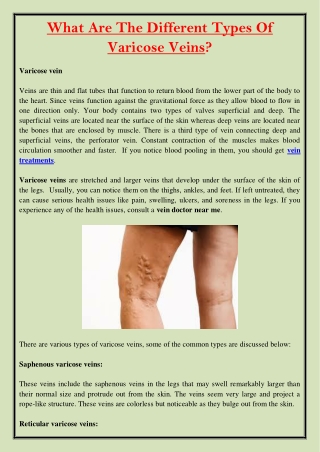 What Are The Different Types Of Varicose Veins?