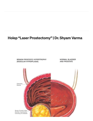 Holep Laser Prostectomy  | Dr. Shyam Varma