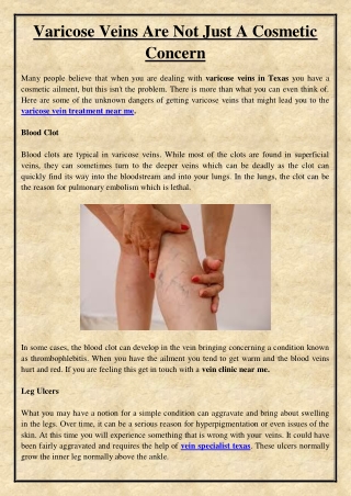 Varicose Veins Are Not Just A Cosmetic Concern