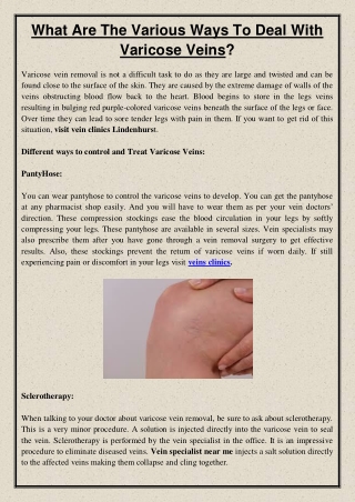 What Are The Various Ways To Deal With Varicose Veins?