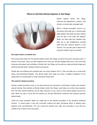 Where to Get Best Dental Implants in San Diego