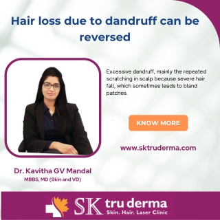 Hair loss and dandruff | Best Dermatologist in Bangalore |Dr.Kavitha GV Mandal | Sktruderma