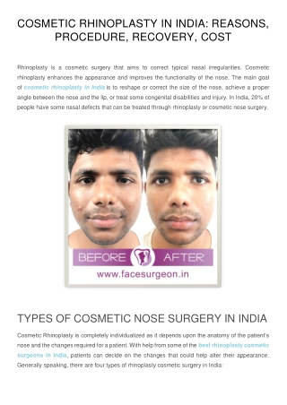 Cost Of Nose Job In India: Cosmetic Rhinoplasty in India