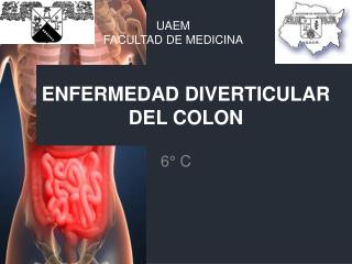 ENFERMEDAD DIVERTICULAR DEL COLON