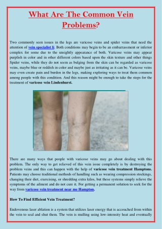 What Are The Common Vein Problems?