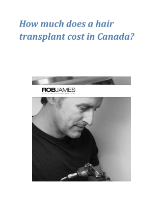 How much does a hair transplant cost in Canada?
