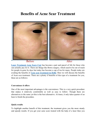 Benefits of Acne Scar Treatment