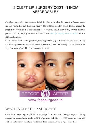 Is Cleft Lip Surgery cost in India Affordable?