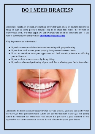 Do I need braces?
