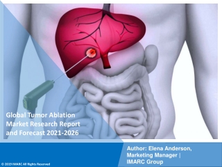 Tumor Ablation  Market PDF 2021-2026: Size, Share, Trends, Analysis & Research Report