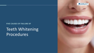 Five Causes of Failure of Teeth Whitening Procedures