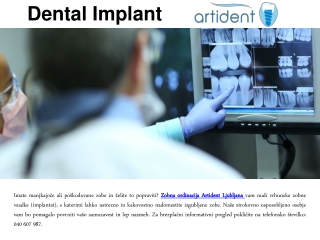 Dental Implant