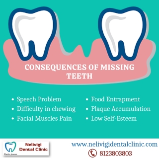 Consequences Of Missing Teeth - Best Dental Clinic in Bangalore - Nelivigi Dental Clinic