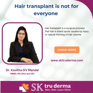Hair transplant |Best Dermatologist in Bangalore | SKTruderma | Dr.Kavitha