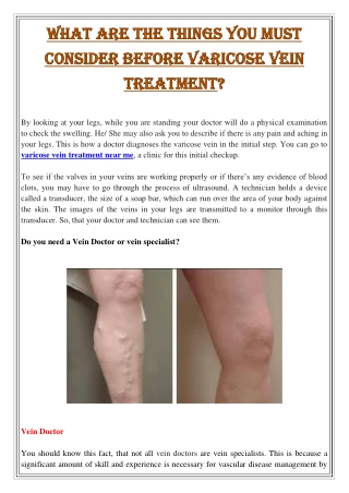 What are the things you must consider before varicose vein treatment