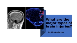 Brain Injury