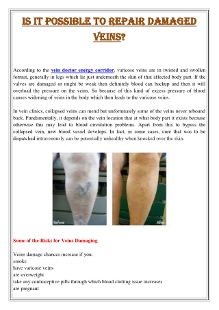 Is It Possible to Repair Damaged Veins