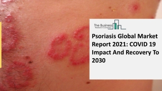 Psoriasis Drugs Market Size, Growth, Trends and Research Analysis by TBRC