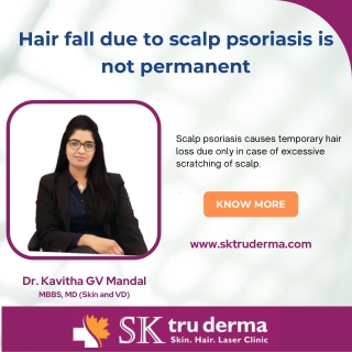 Scalp psoriasis is not permanent |  Dermatologist in sarjapur road |  SKTruderma