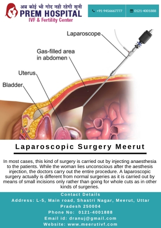 Laparoscopic Surgery in Meerut