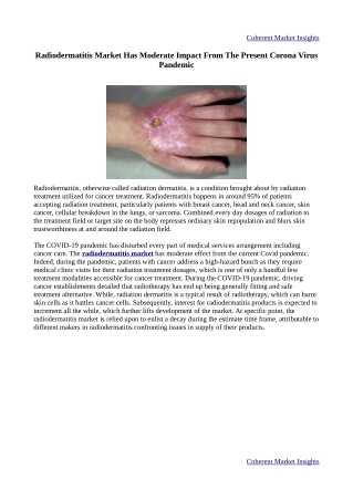 Radiodermatitis Market Report, Size, Share, Growth, Trends and Forecast