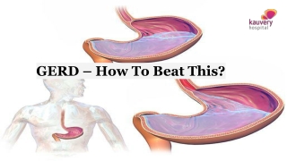 GERD – How To Beat This?