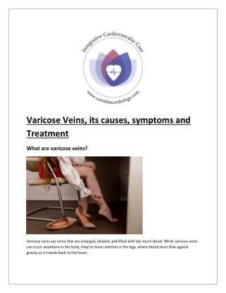 Varicose Veins Specialist in Philadelphia