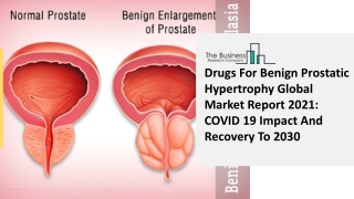 Drugs For Benign Prostatic Hypertrophy Global Market Report 2021 COVID 19 Impact And Recovery To 2030