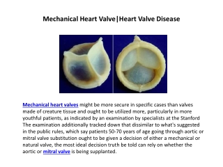 Mechanical Heart Valve