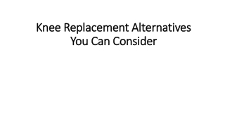 Knee Replacement Alternatives You Can Consider