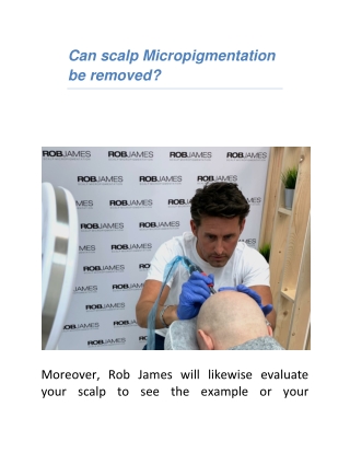 Can scalp Micropigmentation be removed