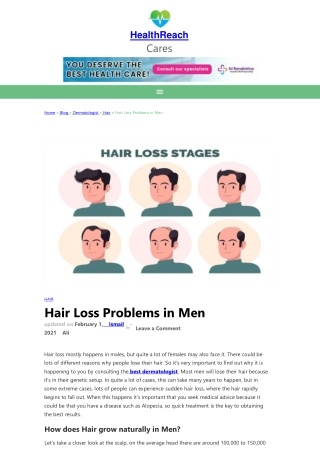 Hair Loss Problems  in Men