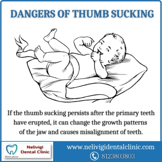 Dangers of thumb sucking | Best Dental Clinic in Bangalore | Nelivigi Dental