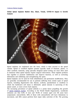 Spinal Implants Market 28