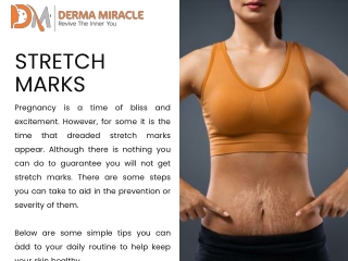 Stretch Mark