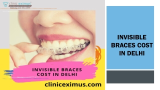 How Much Invisible Braces Cost in Delhi