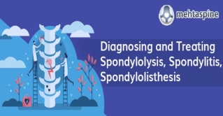 Diagnosing and Treating Spondylolysis, Spondylitis, Spondylolisthesis | Children