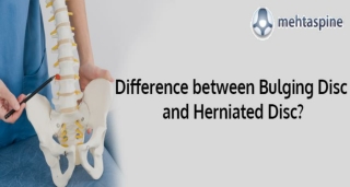 Difference between Bulging Disc and Herniated Disc? | Mehta Spine UK