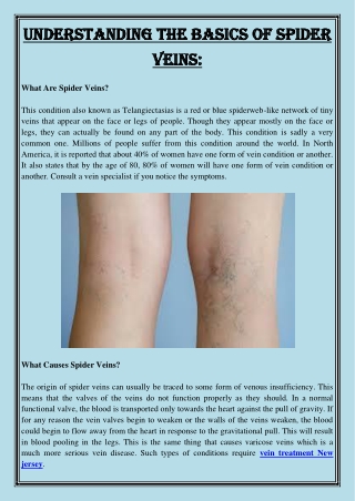 Understanding The Basics Of Spider Veins
