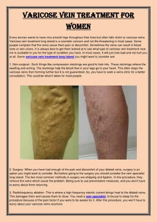 Varicose vein treatment for women