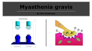 Myasthenia gravis