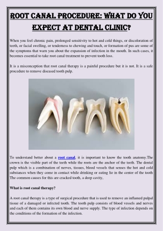Root Canal Procedure What Do you Expect at Dental Clinic