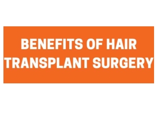 Benefits of Hair Transplant Surgery