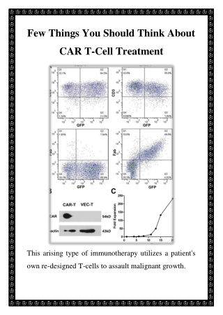 Few Things You Should Think About CAR T-Cell Treatment