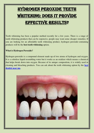 Hydrogen Peroxide Teeth Whitening Does It Provide Effective Results