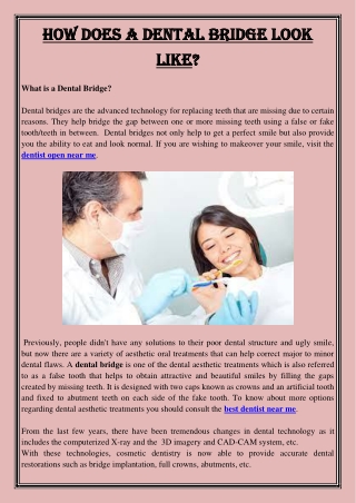 How Does A Dental Bridge Look Like