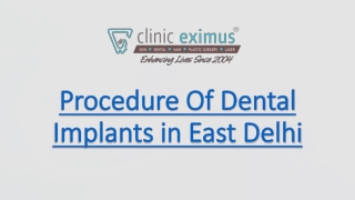 Procedure Of Dental Implants in East Delhi