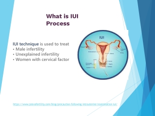 IUI treatment in noida